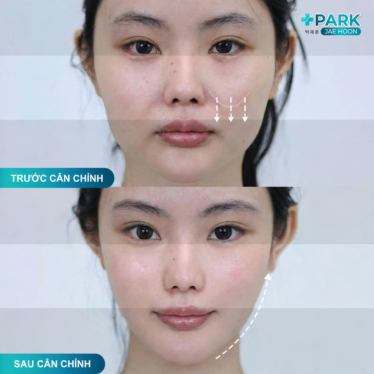 cover-park-jae-hoon-hop-tac-tham-my-jang-sung-su